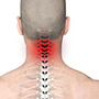 Neck Pain