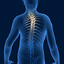 Spine Deformities