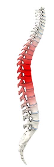 Spine Trauma